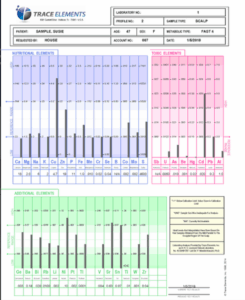 HTMA sample test results